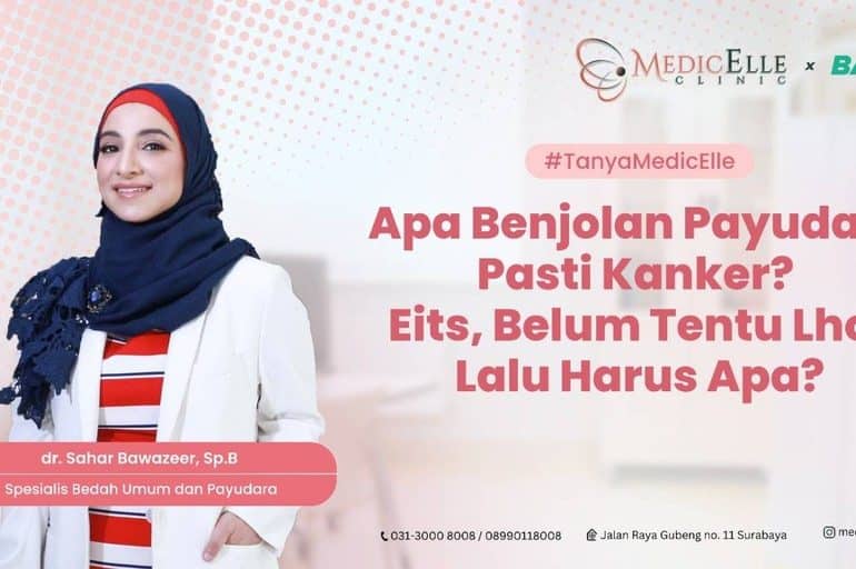 Banner Benjolan Apakah Pasti Kanker