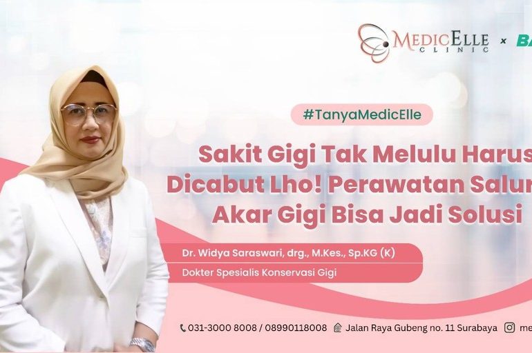 Banner Perawatan Akar Gigi