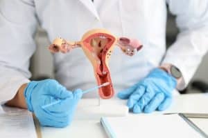Gynecologist memegang anatomi sistem reproduksi wanita