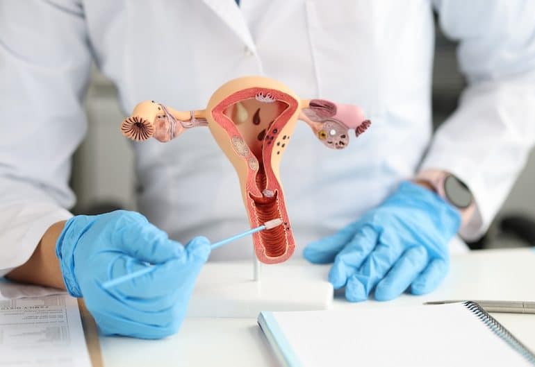Gynecologist memegang anatomi sistem reproduksi wanita
