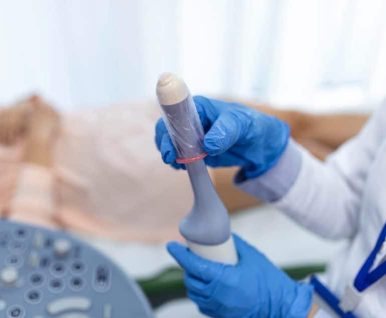 gynecologist mengganti cover alat usg transvaginal