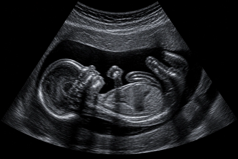 USG Kehamilan per Trimester: Apa Saja yang Harus Dipastikan di Setiap Tahap agar Tidak Sekadar “Lihat Bayi”? 6 Pertumbuhan Ukuran Janin